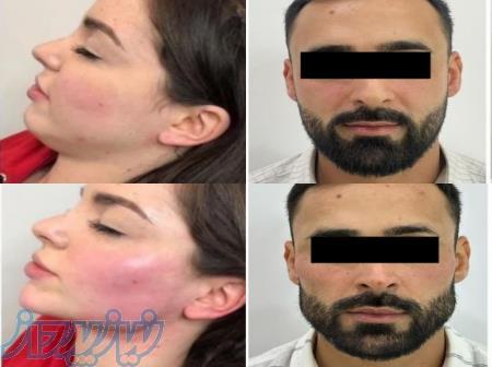 مرکز لیزر تهرانپارس 