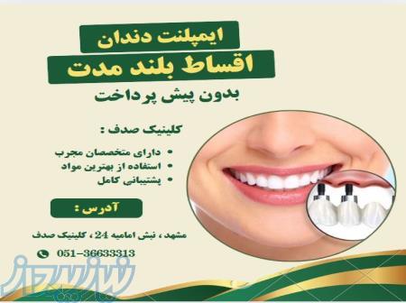 ایمپلنت دندان با کیفیت بالا و پرداخت اقساطی در کلینیک صدف 