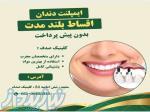 ایمپلنت دندان با کیفیت بالا و پرداخت اقساطی در کلینیک صدف 
