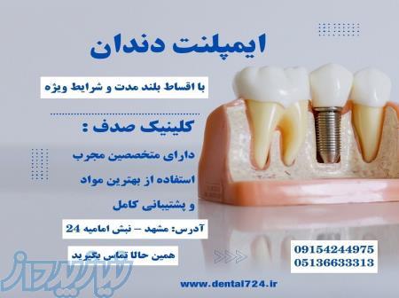 درمان ایمپلنت بدون فشار مالی با اقساط بلند مدت 