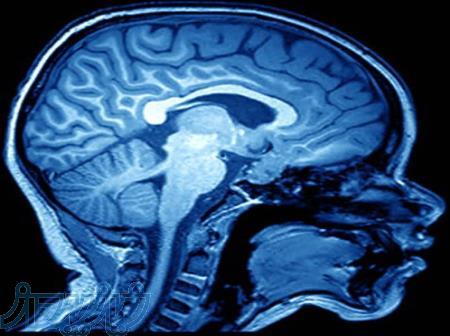 تصاویر پزشکی سی دی و لینک ایالات 