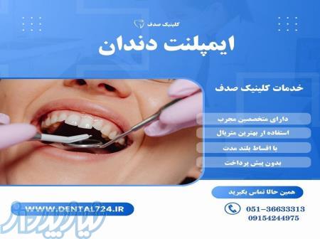 ایمپلنت دندان با کیفیت و عمر طولانی در مشهد 