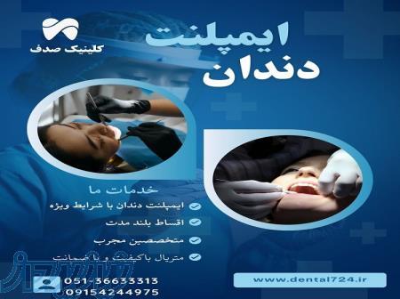 ایمپلنت دندان در مشهد – از دم قسط، بدون سود و بهره! 