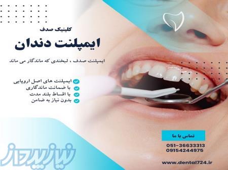 ایمپلنت ، بازسازی عملکرد طبیعی دندان ها با تکنولوژی روز 