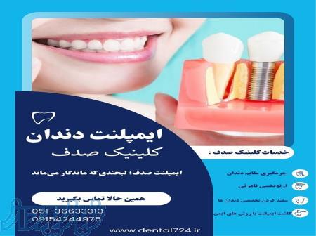 ایمپلنت دندان در مشهد ، کلینیک صدف 