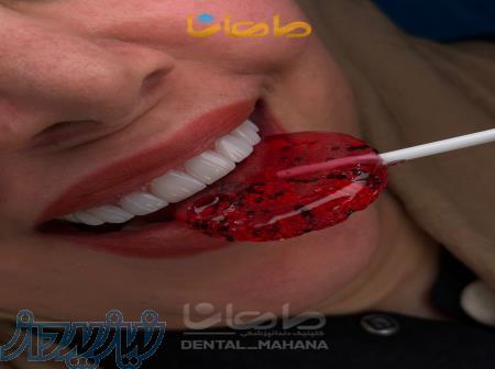 دندانپزشکی زیبایی 
