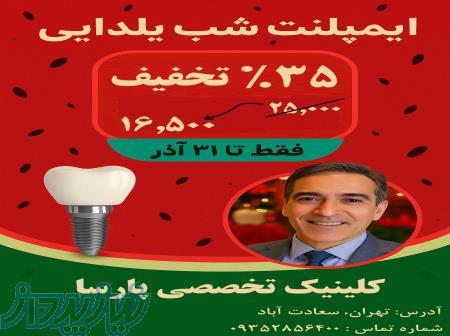 ایمپلنت دیجیتال   کاشت دندان   ویژه شب یلدا 
