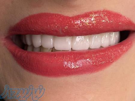 دندانپزشکی در تهران 