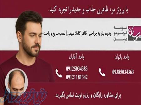 ترمیم و پروتز مو موسان 