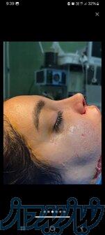 هرجایی بینی ت رو عمل نکن 