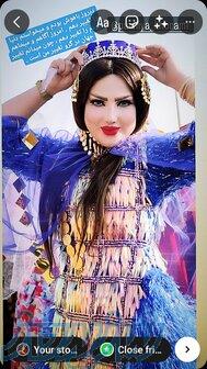 اموزش زلف محلی 