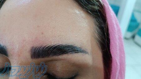 لیفت با قیمت استثنایی   