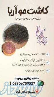 کاشت مو و ابرو با تراکم بالا در شیراز   مشاوره رایگان   طراحی خط رویش طبیعی 