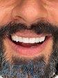بهترین دندانپزشکی تهران برای ایمپلنت 
