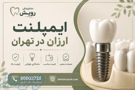 ایمپلنت ارزان در تهران   دندانپزشکی رویش 