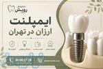 ایمپلنت ارزان در تهران   دندانپزشکی رویش 