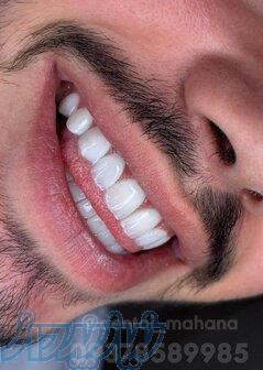 خدمات دندانپزشکی 