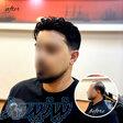 سریع ترین روش بازگشت مو 
