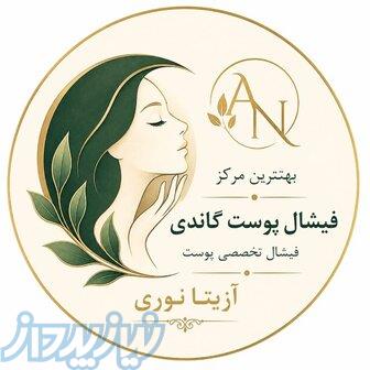 بهترین مرکز فیشال و پاکسازی پوست در ظفر میرداماد شمال تهران 