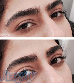 اصلاح تخصصی صورت و ابرو 