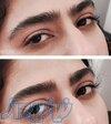 اصلاح تخصصی صورت و ابرو 