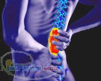 درمان دیسک کمروگردن آتروز و سیاتیک بدون عمل جراحی