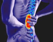 درمان دیسک کمر و سیاتیک بدون عمل جراحی