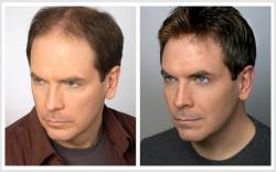 مرکز ترمیم موی چهره گشا  - تهران