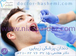دندانپزشکی زیبایی - تهران