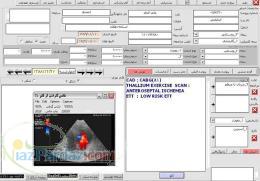 نرم افزار مطب متخصصین قلب و عروق با امکان چاپ اکو