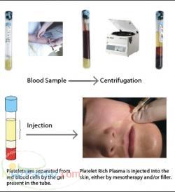 سانتریفیوژ مخصوص PRP - EBA20 (پوست)