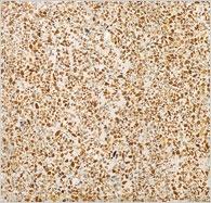 صادرات اعطای نمایندگی سنگ مصنوعی احمدی  - سمنان