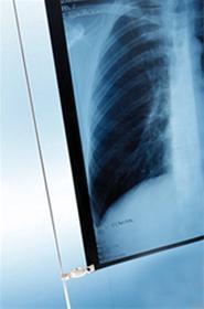 بزرگترین مرکز خرید فیلم رادیولوژی  - قم