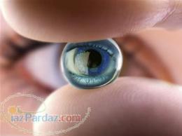 انواع لنز چشم - لنز طبی - لنز طبی رنگی - لنز توریک