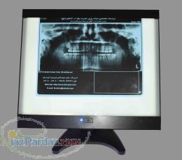 نگاتوسکوپ رومیزی LED