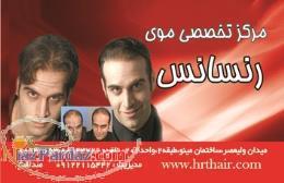 کلینیک تخصصی کاشت مو و جراحی بینی ترمیم موی رنسانس