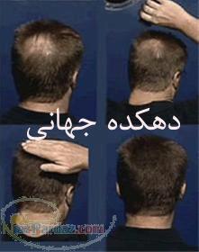 پودر - سوپور بیلیون - حجم دهنده - زیبایی- تاپیک - پرفکت