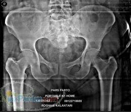 رادیولوژی دیجیتال در منزل 