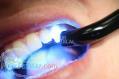 دندانپزشکی ودندانسازی سیاهکوهی (شیراز) 