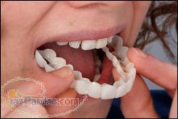 دندانپزشکی دکتر سجودی  ایمپلنت  لمینیت 