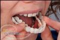 دندانپزشکی دکتر سجودی  ایمپلنت  لمینیت 