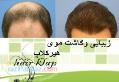 کاشت مو کاشت ابرو hairklap 
