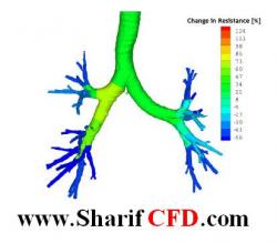 انجام پروژه مهندسی پزشکی  فلوئنت fluent  - تهران