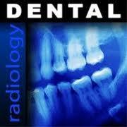 خرید ضایعات فیلم رادیولوژی  - قم