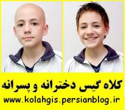 کلاه گیس زنانه و کلاه گیس مردانه طبیعی  - تهران