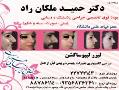 جراحی پلاستیک بینی(دکتر ملکان راد)  - تهران