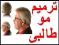 ترمیم مو طبیعی و کاشت موی طبیعی طالبی  - تهران