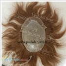 کاشت مو و ترمیم تخصصی مو