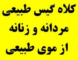 سفارش کلاه گیس زنانه و کلاه گیس مردانه  - تهران