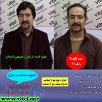 خرید اینترنتی کلاه گیس مردانه و پسرانه ارزان (فشن) 